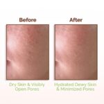 Mamaearth Rice Water Dewy Face Toner with Rice Water & 4% Niacinamide for Glass Skin 150ml |Intensely Hydrates |Minimizes Pores |Even Skin Tone |Korean Rice Toner | Alcohol-Free| Suits All Skin Types